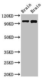 ATP6V0A1 Antibody in Western Blot (WB)