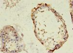 TBC1D20 Antibody in Immunohistochemistry (Paraffin) (IHC (P))