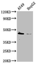 TBC1D20 Antibody in Western Blot (WB)