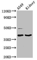 Galectin 12 Antibody in Western Blot (WB)