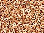 CHMP6 Antibody in Immunohistochemistry (Paraffin) (IHC (P))