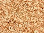 CHMP6 Antibody in Immunohistochemistry (Paraffin) (IHC (P))