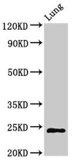 CHMP6 Antibody in Western Blot (WB)