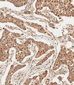 Ubiquitin Antibody in Immunohistochemistry (Paraffin) (IHC (P))