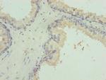VWA9 Antibody in Immunohistochemistry (Paraffin) (IHC (P))