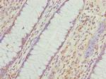 VWA9 Antibody in Immunohistochemistry (Paraffin) (IHC (P))