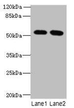 VWA9 Antibody in Western Blot (WB)