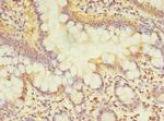 TCP11L2 Antibody in Immunohistochemistry (Paraffin) (IHC (P))