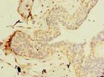 TCP11L2 Antibody in Immunohistochemistry (Paraffin) (IHC (P))