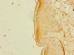 RBM41 Antibody in Immunohistochemistry (Paraffin) (IHC (P))