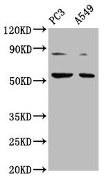 ARX Antibody in Western Blot (WB)