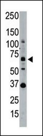 SENP1 Antibody in Western Blot (WB)