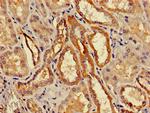 ACMSD Antibody in Immunohistochemistry (Paraffin) (IHC (P))