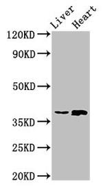 ACMSD Antibody in Western Blot (WB)