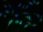 SLC25A36 Antibody in Immunocytochemistry (ICC/IF)