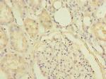 SLC25A36 Antibody in Immunohistochemistry (Paraffin) (IHC (P))