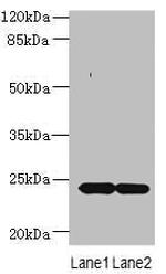 MRAP2 Antibody in Western Blot (WB)