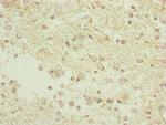 C3orf31 Antibody in Immunohistochemistry (Paraffin) (IHC (P))
