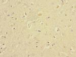 EAF2 Antibody in Immunohistochemistry (Paraffin) (IHC (P))