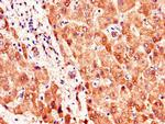 SMO Antibody in Immunohistochemistry (Paraffin) (IHC (P))