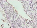 C17orf62 Antibody in Immunohistochemistry (Paraffin) (IHC (P))