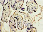 ADAM33 Antibody in Immunohistochemistry (Paraffin) (IHC (P))