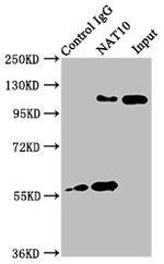 NAT10 Antibody in Immunoprecipitation (IP)