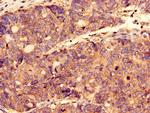 CTPS2 Antibody in Immunohistochemistry (Paraffin) (IHC (P))