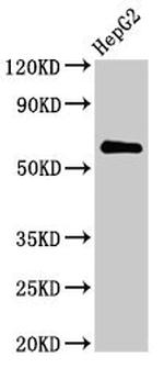 CTPS2 Antibody in Western Blot (WB)