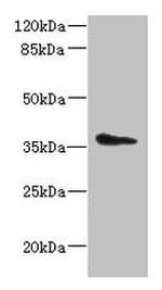 AASDHPPT Antibody in Western Blot (WB)