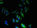 GPR83 Antibody in Immunocytochemistry (ICC/IF)