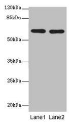 CNOT2 Antibody in Western Blot (WB)