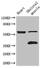 IQCG Antibody in Western Blot (WB)