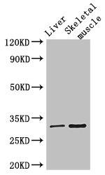 RSPH9 Antibody in Western Blot (WB)