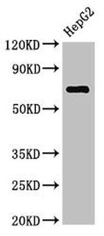 ST6GALNAC1 Antibody in Western Blot (WB)