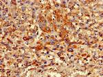 PIPOX Antibody in Immunohistochemistry (Paraffin) (IHC (P))