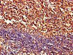 PIPOX Antibody in Immunohistochemistry (Paraffin) (IHC (P))