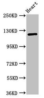 SEMA5B Antibody in Western Blot (WB)