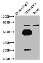 GCP4 Antibody in Immunoprecipitation (IP)