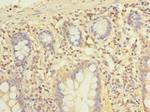 ELTD1 Antibody in Immunohistochemistry (Paraffin) (IHC (P))