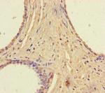 RAVER2 Antibody in Immunohistochemistry (Paraffin) (IHC (P))