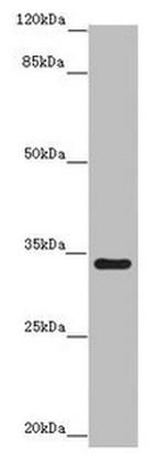 IFT46 Antibody in Western Blot (WB)