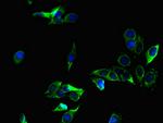 ZC4H2 Antibody in Immunocytochemistry (ICC/IF)