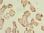 ABI3 Antibody in Immunohistochemistry (Paraffin) (IHC (P))