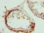 MURF2 Antibody in Immunohistochemistry (Paraffin) (IHC (P))