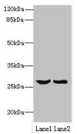 OCIAD1 Antibody in Western Blot (WB)