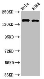 CDK12 Antibody in Western Blot (WB)