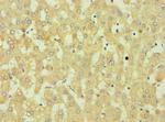 DKK4 Antibody in Immunohistochemistry (Paraffin) (IHC (P))