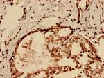 SI-CLP Antibody in Immunohistochemistry (Paraffin) (IHC (P))