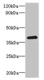 RTDR1 Antibody in Western Blot (WB)